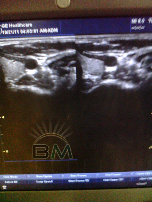 GE 8L - izquierda imagen original - derecha imagen compatible