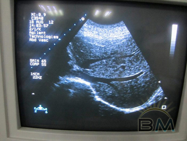 PHILIPS C3540 - Transducer